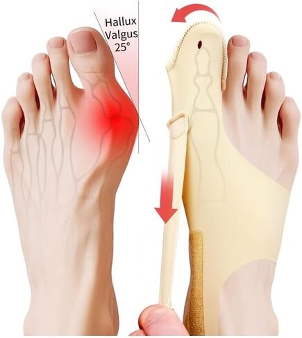 2 Pcs Bunion Corrector & Adjustable Toe Spacer for Women & Men-Big Toe Support with Side & Heel Straps, Hallux Valgus Pain Relief, Comfortable for Day & Night. in Saudi Arabia