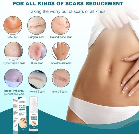 BESTEK Scar Cream, Advance Scar Gel for Surgical Scars,Face,Body,Leg, Burns, Acene,C-Section, Stretch Marks, Keloids,Scar Treatments for Old & New Scars,Scar Removal for Women Men,1.76oz/50ml in Saudi Arabia