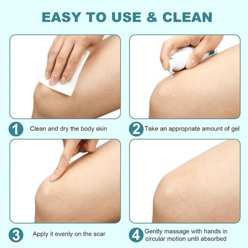 BESTEK Scar Cream, Advance Scar Gel for Surgical Scars,Face,Body,Leg, Burns, Acene,C-Section, Stretch Marks, Keloids,Scar Treatments for Old & New Scars,Scar Removal for Women Men,1.76oz/50ml in Saudi Arabia