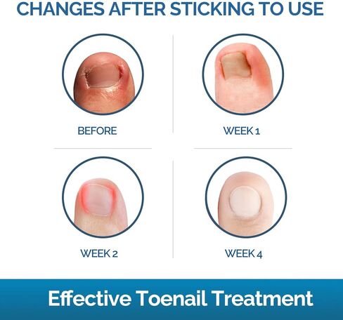 وورلد مارك 90206-4 مكبس ريدنيك، 5-3/4 بوصة in Kuwait