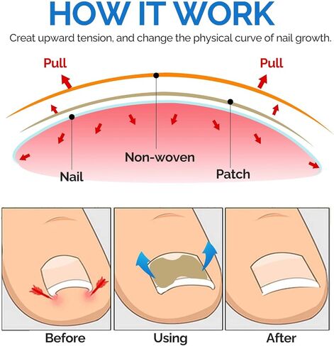 وورلد مارك 90206-4 مكبس ريدنيك، 5-3/4 بوصة in Kuwait