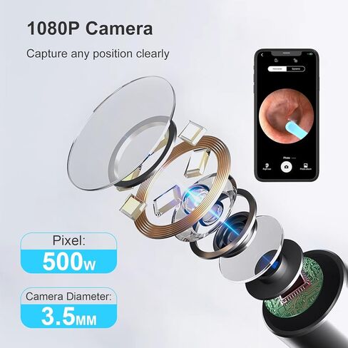 كاميرا أداة إزالة شمع الأذن، مجموعة تنظيف الأذن لإزالة شمع الأذن مع كاميرا للأذن بدقة 1080 بكسل عالية الدقة لمجموعة تنظيف الأذن مع أمان عالي للغاية وسعة بطارية كبيرة لأجهزة iOS وAndroid in Kuwait