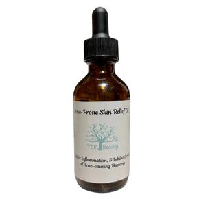 Acne Prone Skin Relief -100% Pure Organic Jojoba, Rosehip, & Sunflower Oils - 2 oz
