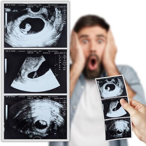 Personalized Pregnancy Prank Ultrasound Photos | Customized Ultrasound Positive Test Results Strip of 3 Photos from real ultrasound printer | Hilarious Gag gift in Kuwait