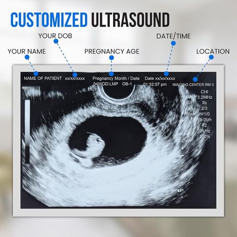 Personalized Pregnancy Prank Ultrasound Photos | Customized Ultrasound Positive Test Results Strip of 3 Photos from real ultrasound printer | Hilarious Gag gift in Kuwait