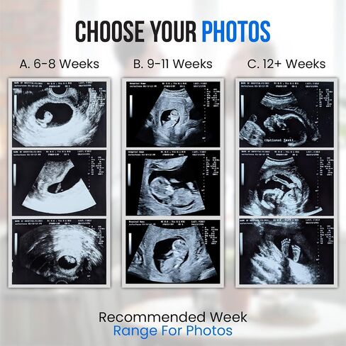 Personalized Pregnancy Prank Ultrasound Photos | Customized Ultrasound Positive Test Results Strip of 3 Photos from real ultrasound printer | Hilarious Gag gift in Kuwait