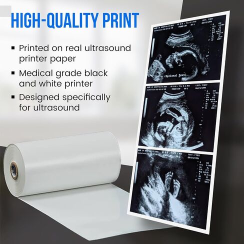 Personalized Pregnancy Prank Ultrasound Photos | Customized Ultrasound Positive Test Results Strip of 3 Photos from real ultrasound printer | Hilarious Gag gift in Kuwait