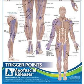 Two Trigger Point Anatomy Maps - Medical Office Wall Poster for Reference by Massage Therapists, Physical Therapists, Chiropractors, Trainers - Pressure Point and Referred Pain Chart