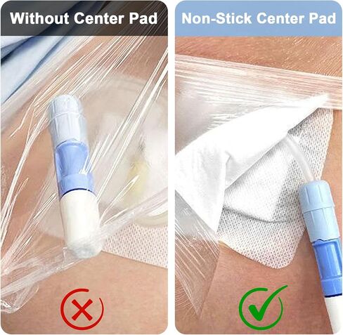 وسادات ضمادات جزيرة لاصقة للقسم، حاجز غطاء الجرح، رقعة ماصة، ضمادة شفافة مقاومة للماء - 10 قطع - 9 * 9 سم in Kuwait