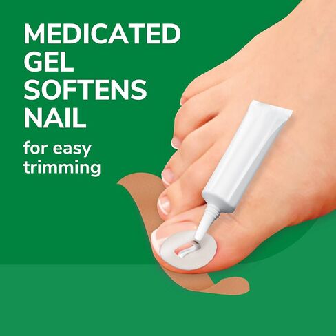 Dr. Scholl's INGROWN TOENAIL PAIN RELIEVER & TRIMMING KIT, 0.3 oz // Only OTC Treatment Proven to Relieve Ingrown Toenail Pain - Includes Medicated Gel + Foam Rings + Bandages + Clipper & Pusher Tools in Saudi Arabia