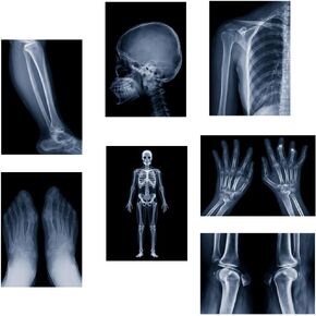 X-ray Science Education Package for Human Anatomy and Bone Parts is Suitable for Light Table and lamp Fittings.