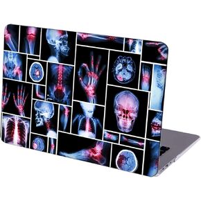 Case Compatible with MacBook Air 13 inch Retina Display with Touch ID, Hard Protective Shell with Keyboard Cover (M1 A2337 A2179 A1932, 2018 2019 2020 Release) - X-Ray Human Skeleton-2