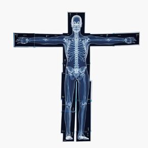 21pcs Human Body Xrays for Kids Educational Set | X Rays for Classroom | Toddler X Ray Toy | Skeleton Xray | X-Ray Science Kit |STEM/STEAM Science Materials for Classroom & Home | Size 33.85" X 35.82"