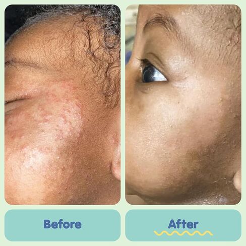 Tubby Todd Baby Bath & Skincare Kit - The Baby Bundle - Baby Shampoo and Body Wash, Everyday Lotion, All Over Ointment & Diaper Paste Cream Gift Set - Full Size Fragrance-Free in Kuwait