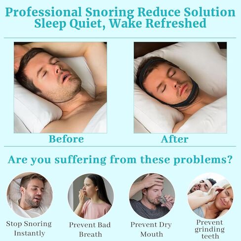 Anti Snoring Chin Strap for Sleeping, 2 Pack Adjustable Jaw Support Strap to Keep Mouth Closed, Soft Snoring Solution for Men Women, Stops Snoring Dry Mouth, Comfort Fit Nighttime Sleeping Aid in Kuwait