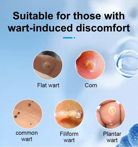 قلم RART & MOLE REAM FOR FACE & BODY - قلم مصحح علامة الجلد مع قضيب دقيق ، إزالة الثآليل الأخمصية ، صيغة عشبية طبيعية لطيفة لجميع أنواع البشرة (2) in Kuwait