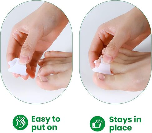 Bukihome Hammertoe Corrector - 6 Pack Toe Straightener to Curled Toes, Broken toe, Bunion Corrector for Women and Men, Small Size (Clear) in Kuwait