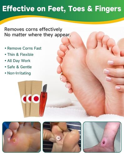 Corn Remover Pads for Feet & Toes – Professional Foot Corn Remover Kit with Removal Pads, PU Film, Remover Tool & Corn Cushions, Complete Corn Removal & Recovery Care for Hard Skin & Calluses in Saudi Arabia