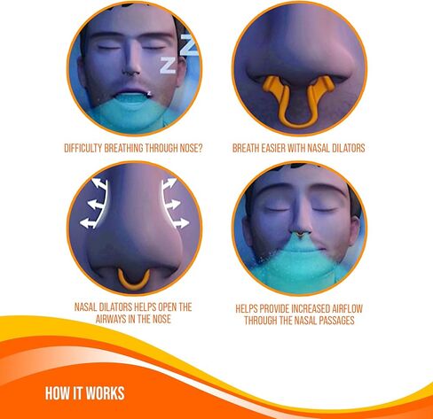 موسعات الأنف للشخير - موسع الأنف المضاد للشخير للتنفس - مساعدات تنفس الأنف للرجال والنساء - موسع الأنف المرن للنوم والتمرين - 4 عبوات، 2 صغير و2 متوسط ​​- من Mobi Lock in Kuwait