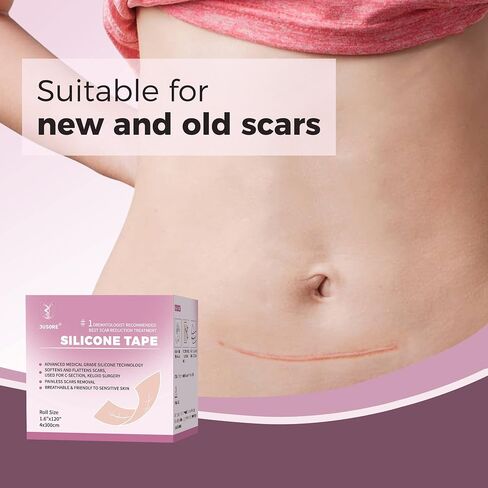 Professional Medical Silicone Scar Tape - Grade Scar Sheets, Non irritating, Painless for C-Section, Surgical Scars, Burn, Keloid, Acne, Provide Safe and Effective Solutions(1.6" x 60" Roll) in Saudi Arabia