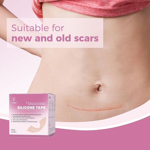 Professional Medical Silicone Scar Tape - Grade Scar Sheets, Non irritating, Painless for C-Section, Surgical Scars, Burn, Keloid, Acne, Provide Safe and Effective Solutions(1.6" x 60" Roll) in Saudi Arabia