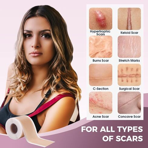 Professional Medical Silicone Scar Tape - Grade Scar Sheets, Non irritating, Painless for C-Section, Surgical Scars, Burn, Keloid, Acne, Provide Safe and Effective Solutions(1.6" x 60" Roll) in Saudi Arabia