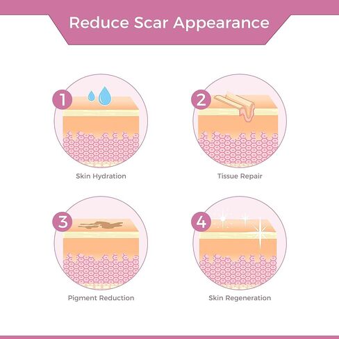 Professional Medical Silicone Scar Tape - Grade Scar Sheets, Non irritating, Painless for C-Section, Surgical Scars, Burn, Keloid, Acne, Provide Safe and Effective Solutions(1.6" x 60" Roll) in Saudi Arabia