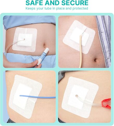 Split Drain Adhesive Bandages 4" x 4" Pre-Cut for Feeding Tubes, Dialysis Catheters & Drains - Soft Non-Stick Pad - Individually Wrapped 20 Pack Wound Dressing Pads in Saudi Arabia