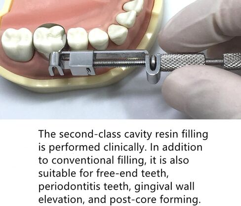 أربطة مصفوفة الأسنان Tofflemire Matrix Retainer الفولاذ المقاوم للصدأ انحناء كبير مقطعي مصفوفات محيطية أداة طب الأسنان (40 قطعة انحناء كبير) in Kuwait