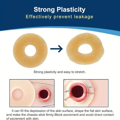 20 PCS Ostomy Barrier Rings, 2mm Thickness Moldable Colostomy Rings, Medical Grade Hydrocolloid Adhesive Barrier Rings Better Seal for Ostomy Supplies (Box of 20) in Kuwait