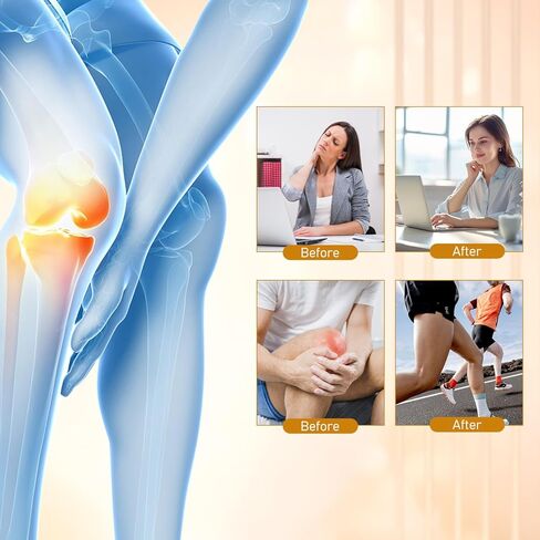 2Pcs Botulinum Toxin & Bee Venom-Relief Bone Healing Cream, Bee Venom Cream Joint Relief Gel, Advanced Joint and Bone C-ream for Back, Knee, Hands and Neck in Kuwait