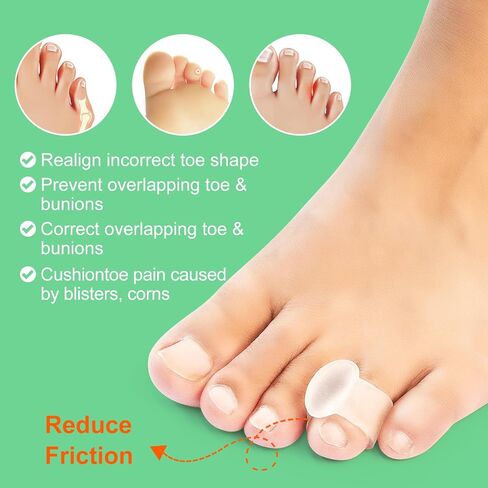 Niupiour Silicone Toe Separator - 14 Pack Gel Toe Spacers for for Women and Men, Toe Corrector for Women and Men, Toe Straightener for Bunions, Overlapping Toe, Hammer Toe, Say Goodbye to Pain in Saudi Arabia