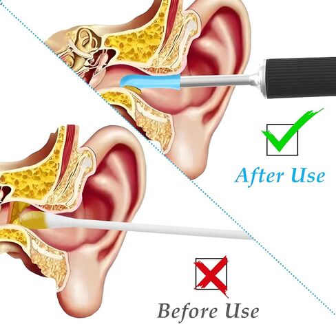 60PCS Ear Camera Replacement Tips, Silicone Suear Replacement Tips for Wet/Dry Ear Cleaning, Ears Cleaner Tip, for Teens and Adults Ears Removal Endoscope, Blue in Kuwait