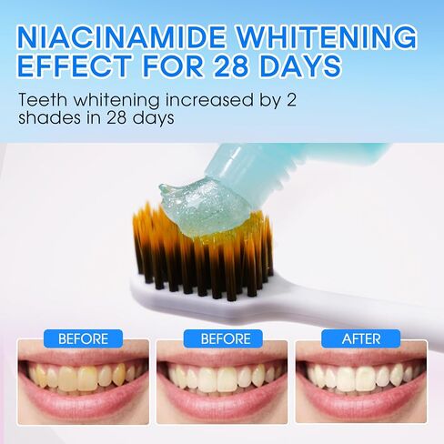 Hotluck Niacinamide Toothpaste, Tooth Paste for Gum Disease Repair, with Natural Peppermint Flavor for Teeth Whitening, Antimicrobial, Remineralizing Enamel &Sensitive Relief, 3.53 Oz(2 Pack) in Saudi Arabia