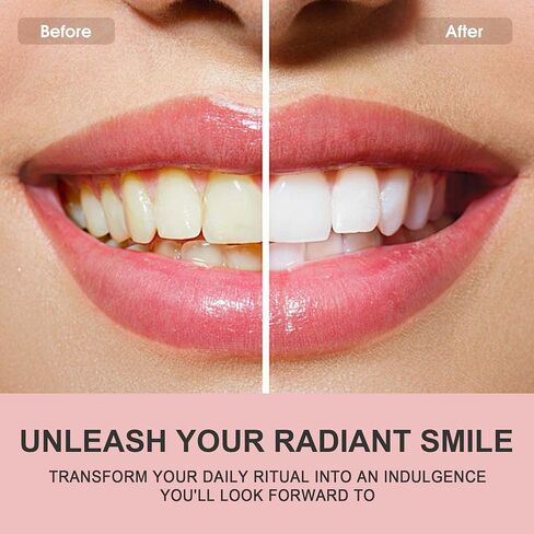 Hotluck Niacinamide Toothpaste, Tooth Paste for Gum Disease Repair, with Natural Peppermint Flavor for Teeth Whitening, Antimicrobial, Remineralizing Enamel &Sensitive Relief, 3.53 Oz(2 Pack) in Saudi Arabia