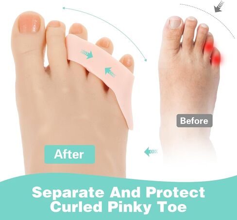 8pcs gel pinky toe freftorators toe gel pinky مصحح مرقا لها حماة رياضية صحة الراحة للنساء العناية بالأقدام من الرجال الذين يمنعون الضغط على الدعم الثابت in Saudi Arabia
