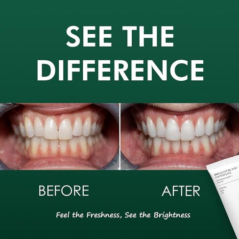 Brilliant Hydroxyapatite Charcoal Toothpaste for Whitening Teeth– Natural Vegan Sensitive in Saudi Arabia