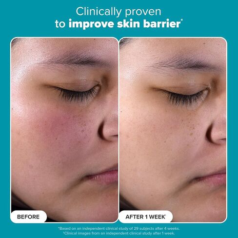 Paula's Choice SKIN PERFECTING 2% BHA Liquid Salicylic Acid Exfoliant-Facial Exfoliant for Blackheads, Enlarged Pores, Wrinkles & Fine Lines in Kuwait