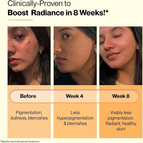 SETU Skin Renew, Glutathione with Vitamin C, Gluta Fizz, Supports Detoxification, Sugar-Free, Orange Flavour, 30 Effervescent Tablets in Saudi Arabia