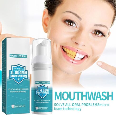 معجون أسنان رغوي، معجون أسنان مبيض، رغوة موس فائقة النعومة لتنظيف اللثة بعمق، للتنظيف العميق للثة، وإزالة البقع والنفس المنعش (2 × 30 مل) in Kuwait