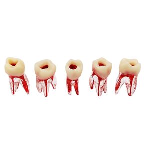 Dental Root Canal Pulp Cavity Practice Endodontic Pulp-Opened RCT Teeth Model M8008 36# Typodont Standard 1:1 Teach Study 5 Pcs