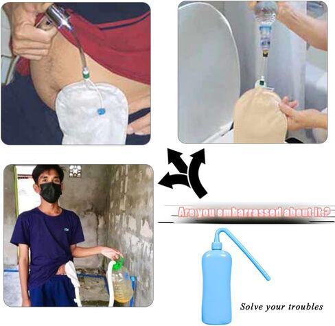 زجاجة غسيل كيس فغر القولون لأداة تنظيف كيس فغر القولون، السعة: 350 مل، قابلة لإعادة الاستخدام in Kuwait