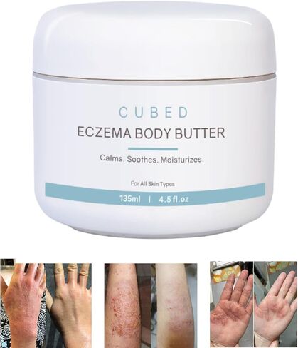 4.5 oz Eczema Cream for Adults, Eczema Relief, Eczema Treatment, Moisturize Dry Irridated Skin, Smart Lotion for Topical Steroid Withdrawal Symptoms, Psoriasis & Rosacea, Eczema, Dermatitis in Saudi Arabia