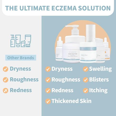 4.5 oz Eczema Cream for Adults, Eczema Relief, Eczema Treatment, Moisturize Dry Irridated Skin, Smart Lotion for Topical Steroid Withdrawal Symptoms, Psoriasis & Rosacea, Eczema, Dermatitis in Saudi Arabia