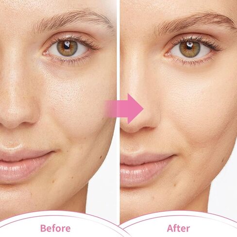 Reusable Ice Face Mask Set - Hot & Cold Therapy for Migraine, Wisdom Tooth Pain, Puffiness Relief with 2 Silicone Covers, Cooling Gel Pad for Swelling in Kuwait