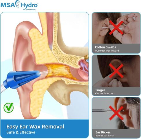 MSA Hydro Ear Wax Remover Kit, Safe, Quick and Effective Ear Cleaning, Gentle Ear Irrigation and Flushing, Adults and Children, Adjustable Water Pressure (Hydro Kit) in Saudi Arabia