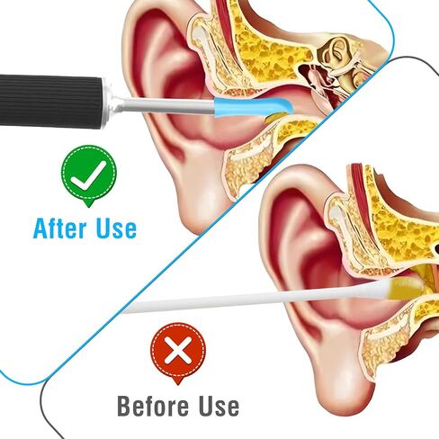 60pcs Ear Camera Replacement Tips, Silicone Ear Wax Removal Tips for Wet/Dry Ear Wax Cleaning for Teens Adults Ear Wax Removal Endoscope in Saudi Arabia