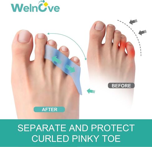 Welnove Gel Pinky Toe Separators - 8 Pack Pinky Toe Spacers, Bunion Cushions Pads for Women＆Men, Silicone Little Toe Protectors for Preventing Rubbing & Relieve Pressure(Clear) in Kuwait