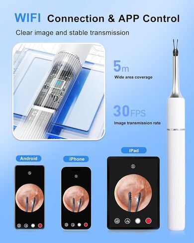 MEKK Ear Wax Removal Kit S5 with 10 MP Camera, Precision Tweezers, 12 Ear Spoons, Wireless Otoscope Ear Cleaner for iOS & Android in Kuwait
