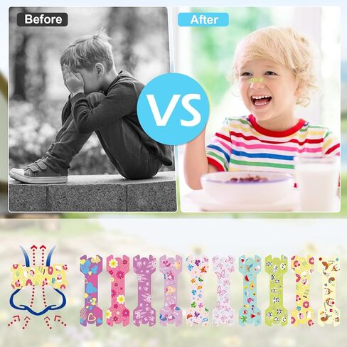 30 عددًا صغيرًا من شرائح أنف الأطفال 1.73 * 0.55 فتيات يتنفسون شرائح الأنف لشخير شرائح الأنف الرسوم المتحركة للأطفال in Kuwait